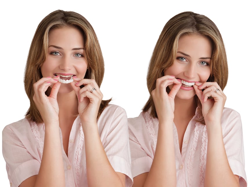 Mujer aplicando Snap-On Smile