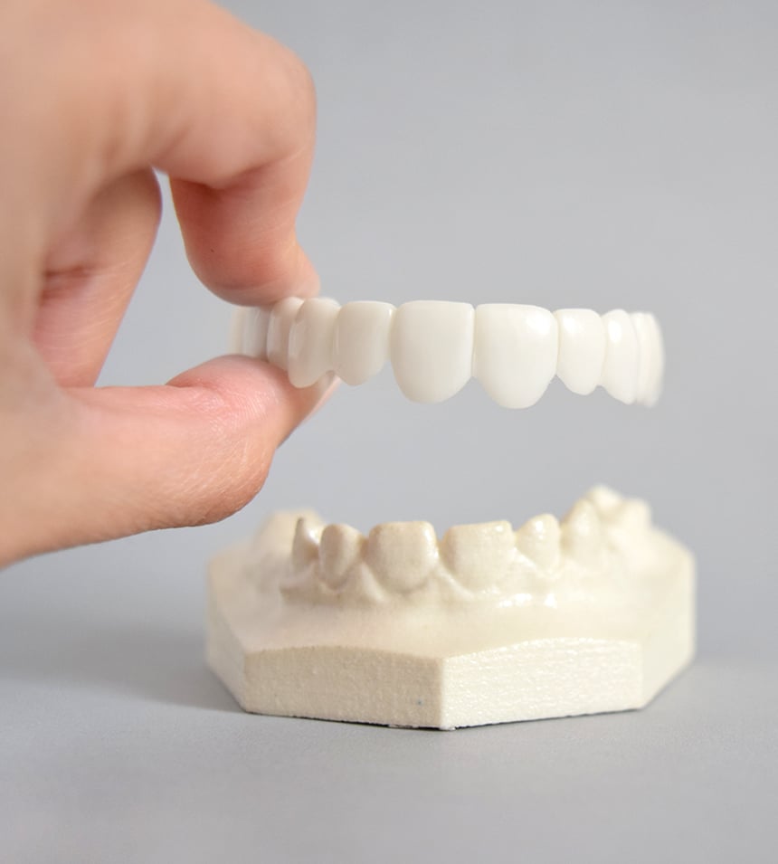 Snap-On Smile en modelo dental